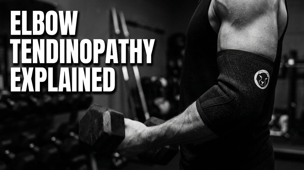 What Is Elbow Tendinopathy and How Do You Train Through It?